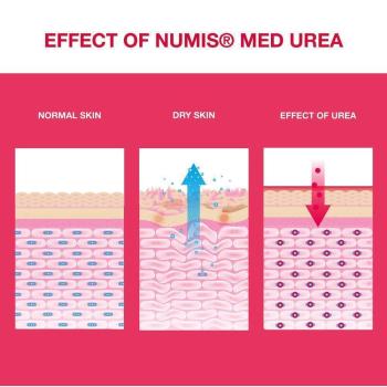numis-med-urea-10-fusscreme-100-ml-395081~2.jpg