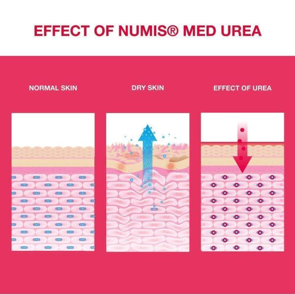 numis-med-urea-10-fusscreme-100-ml-395081~2.jpg